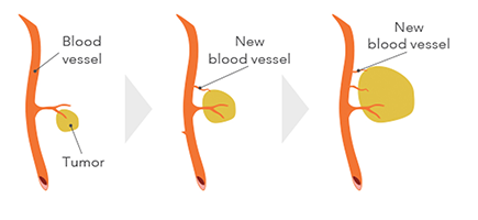 抗毛细血管内皮细胞细胞生长因子有什么可靠的药品？