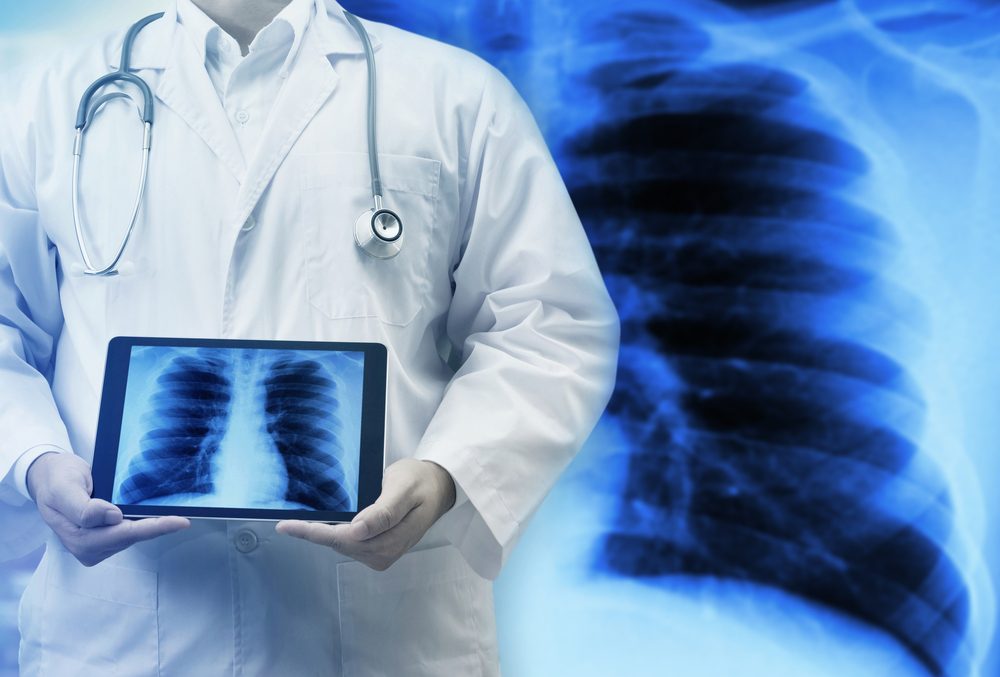 肺动脉高压患者服用波生坦会出现哪些不良反应？